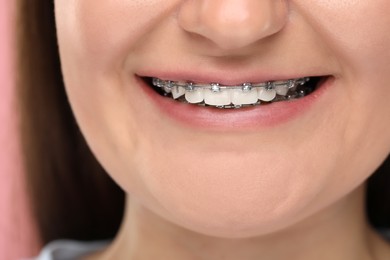 Photo of Smiling woman with dental braces on pink background, closeup