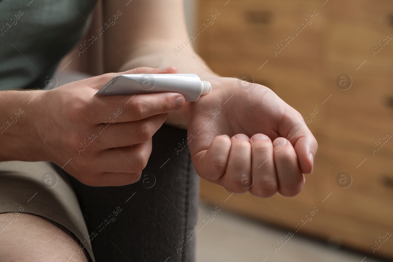 Photo of Man applying ointment from tube onto his wrist indoors, closeup