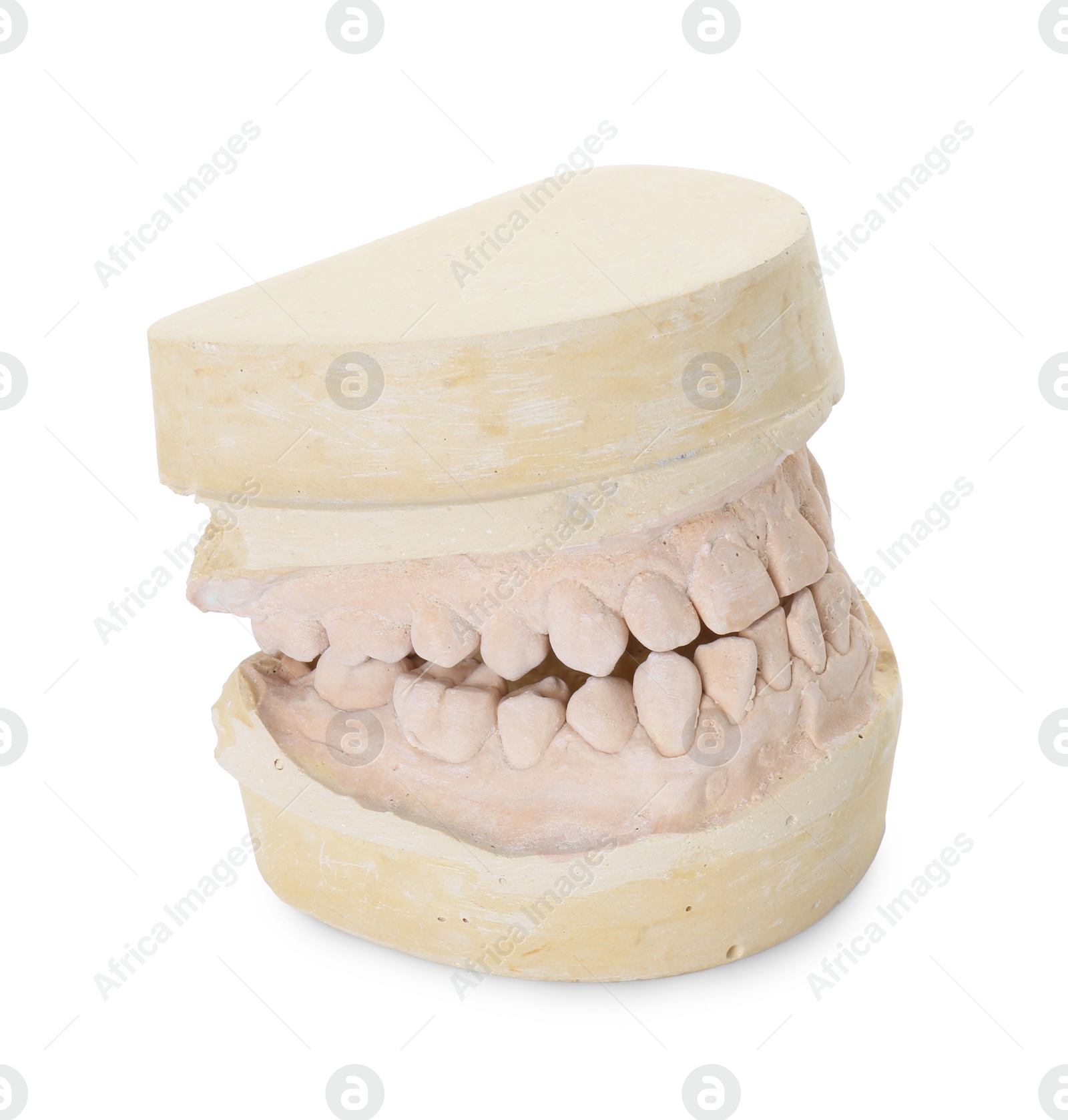 Photo of Dental model with jaws isolated on white. Cast of teeth