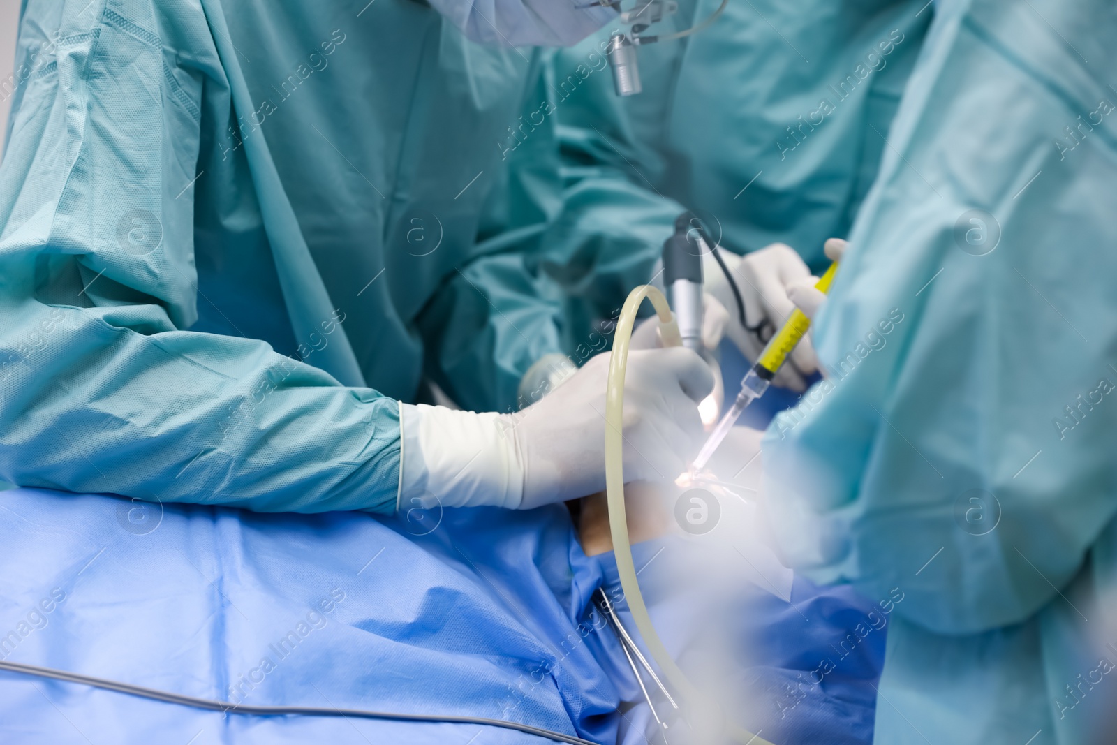 Photo of Professional doctors performing 
frontal sinus trephination in surgery room, closeup