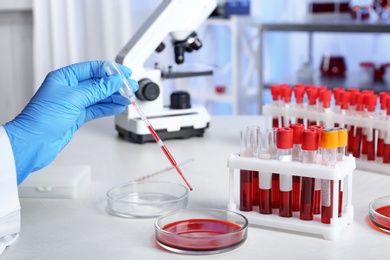 Laboratory worker pipetting blood sample into Petri dish for analysis on table, closeup