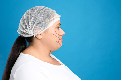 Photo of Woman with double chin ready for cosmetic surgery operation on blue background