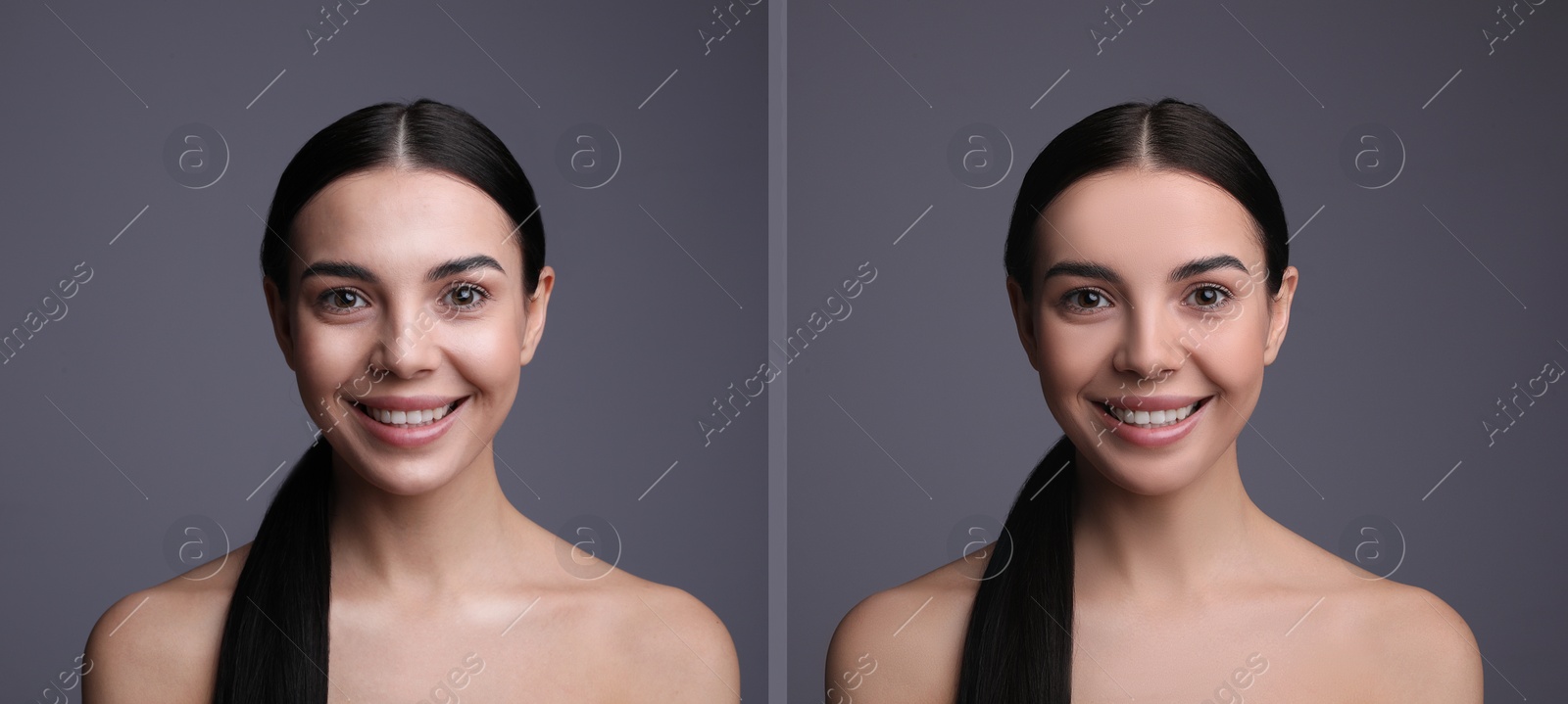 Image of Collage with photos of beautiful young woman before and after using mattifying wipes on grey background. Banner design