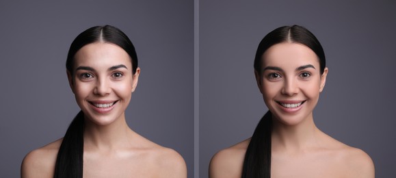 Image of Collage with photos of beautiful young woman before and after using mattifying wipes on grey background. Banner design