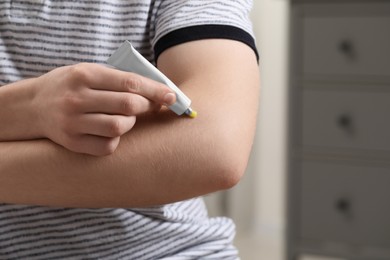 Photo of Man applying yellow ointment from tube onto arm indoors, closeup