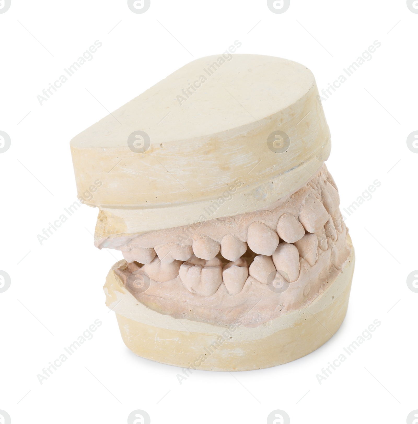 Photo of Dental model with jaws isolated on white. Cast of teeth