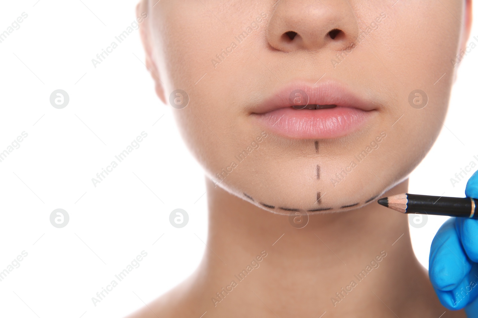Photo of Doctor marking young woman face before cosmetic surgery on white background, closeup