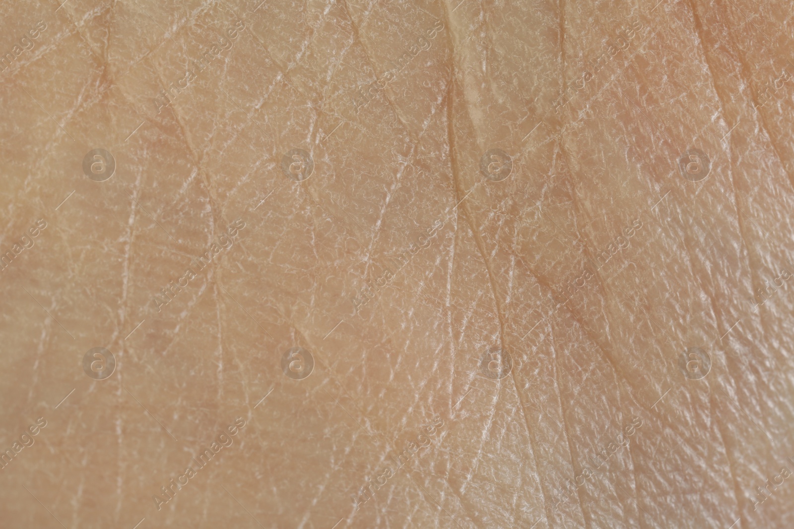Photo of Texture of dry skin as background, macro view