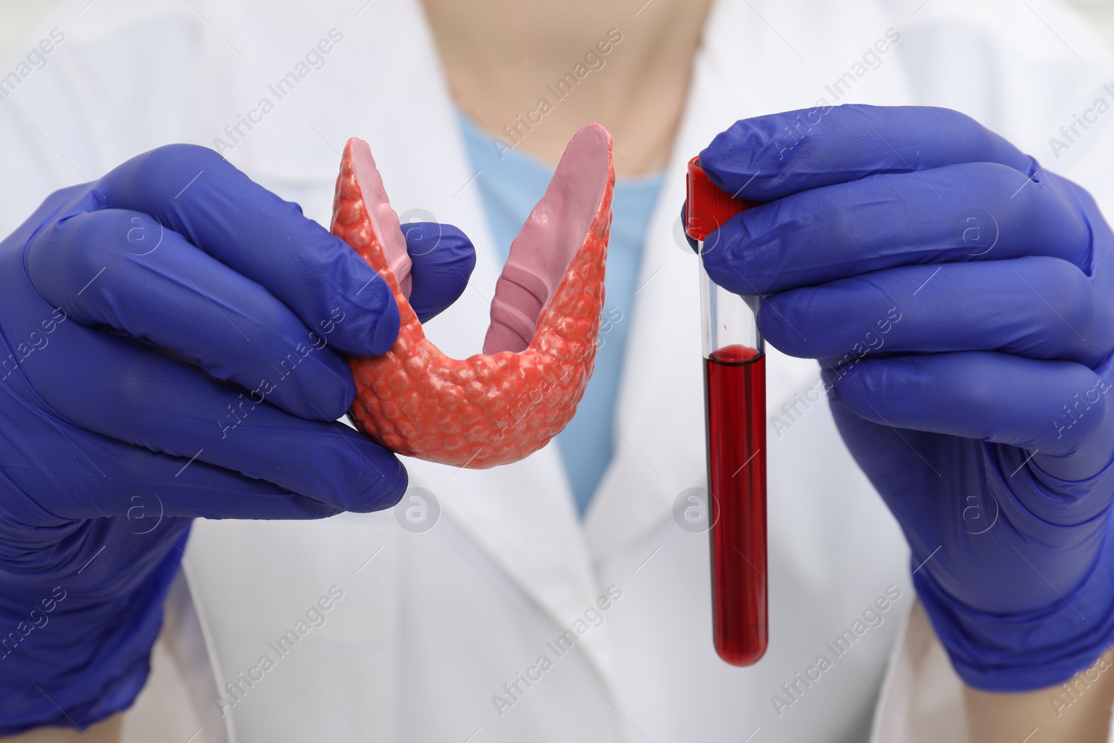 Photo of Endocrinologist showing thyroid gland model and blood sample in test tube, closeup