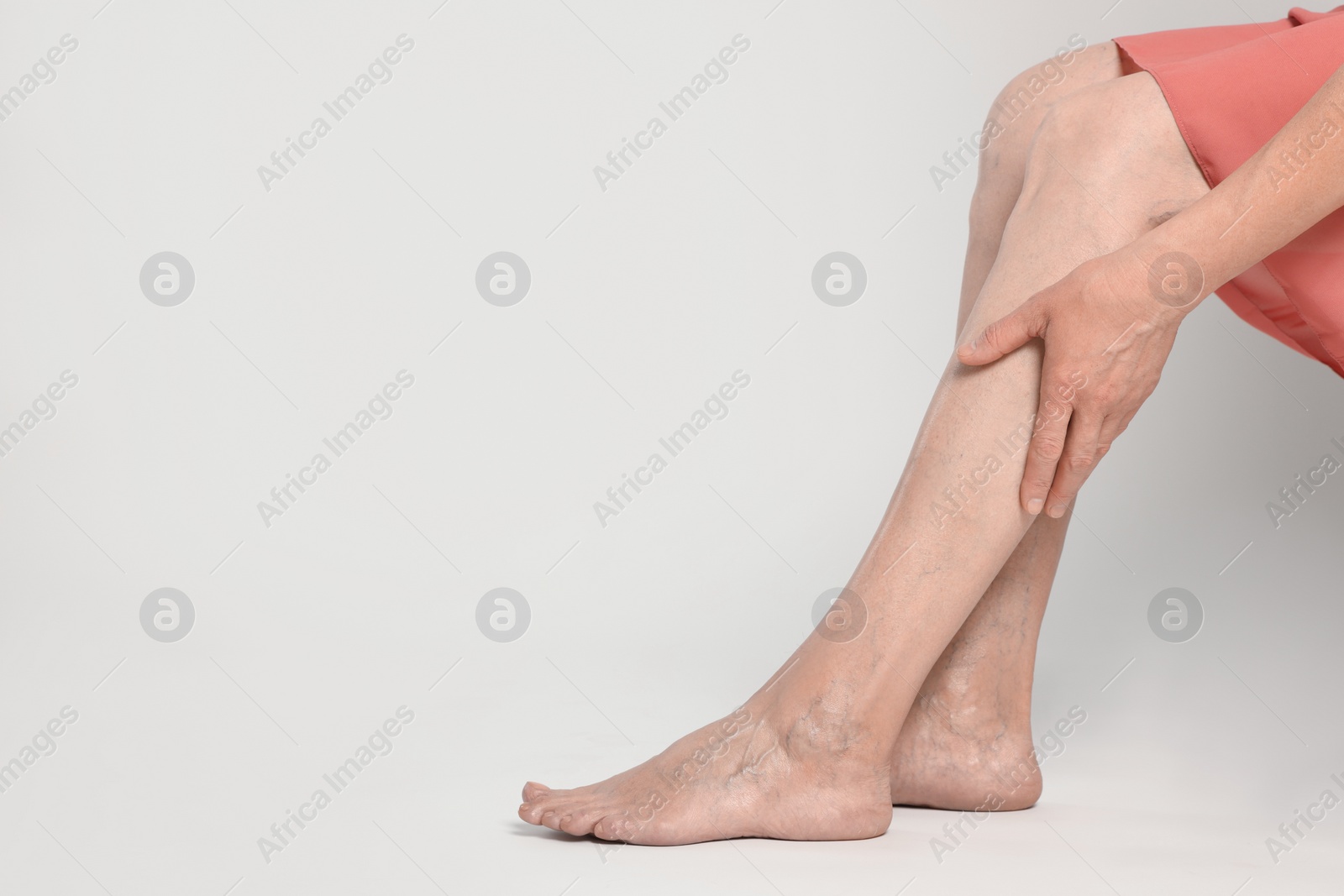 Photo of Closeup view of woman suffering from varicose veins on light background. Space for text