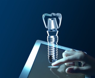 Closeup view of woman using tablet and illustration of dental implant on blue background