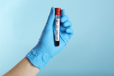 Scientist holding tube with blood sample and label HIV Test on light blue background, closeup