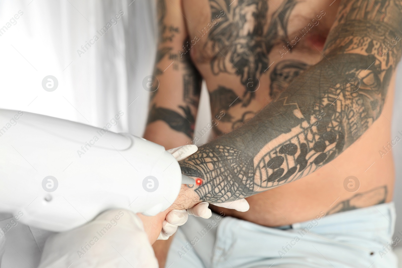 Photo of Man undergoing laser tattoo removal procedure in salon, closeup