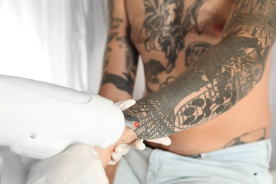 Photo of Man undergoing laser tattoo removal procedure in salon, closeup