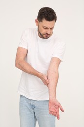 Photo of Man with rash suffering from monkeypox virus on beige background
