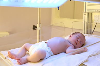 Newborn child under ultraviolet light in hospital