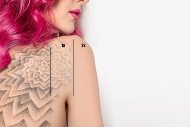 Image of Woman before and after laser tattoo removal procedures on white background, closeup