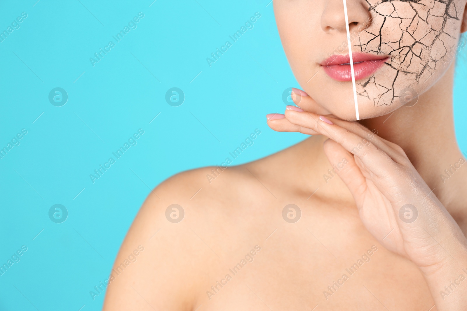 Image of Dry skin treatment. Beautiful young woman before and after procedure on light blue background, closeup. Space for text