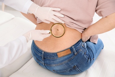 Dermatologist examining mature patient's birthmark with magnifying glass in clinic, closeup