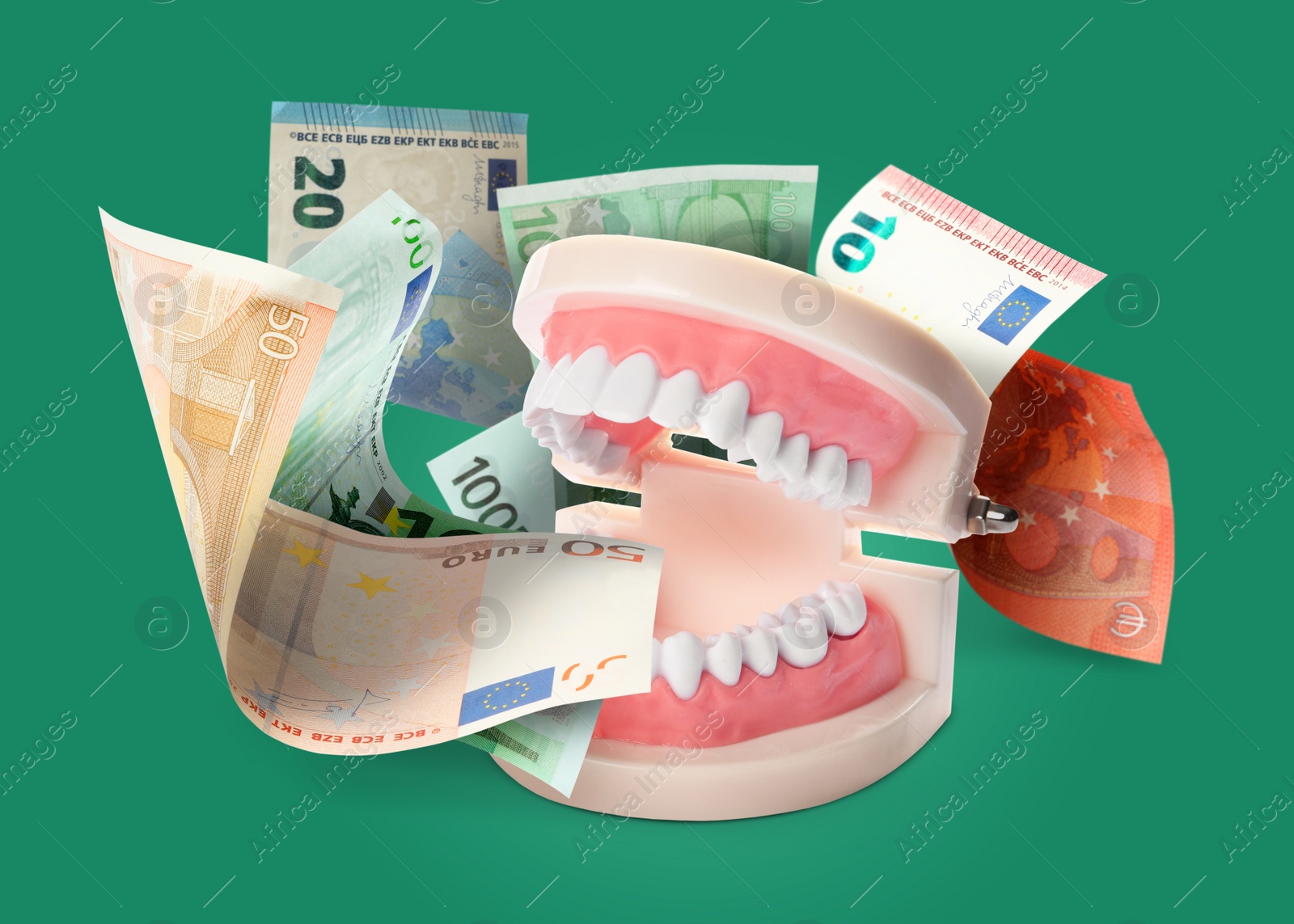 Image of Model of oral cavity with teeth and euro banknotes on green background. Concept of expensive dental procedures