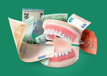 Image of Model of oral cavity with teeth and euro banknotes on green background. Concept of expensive dental procedures