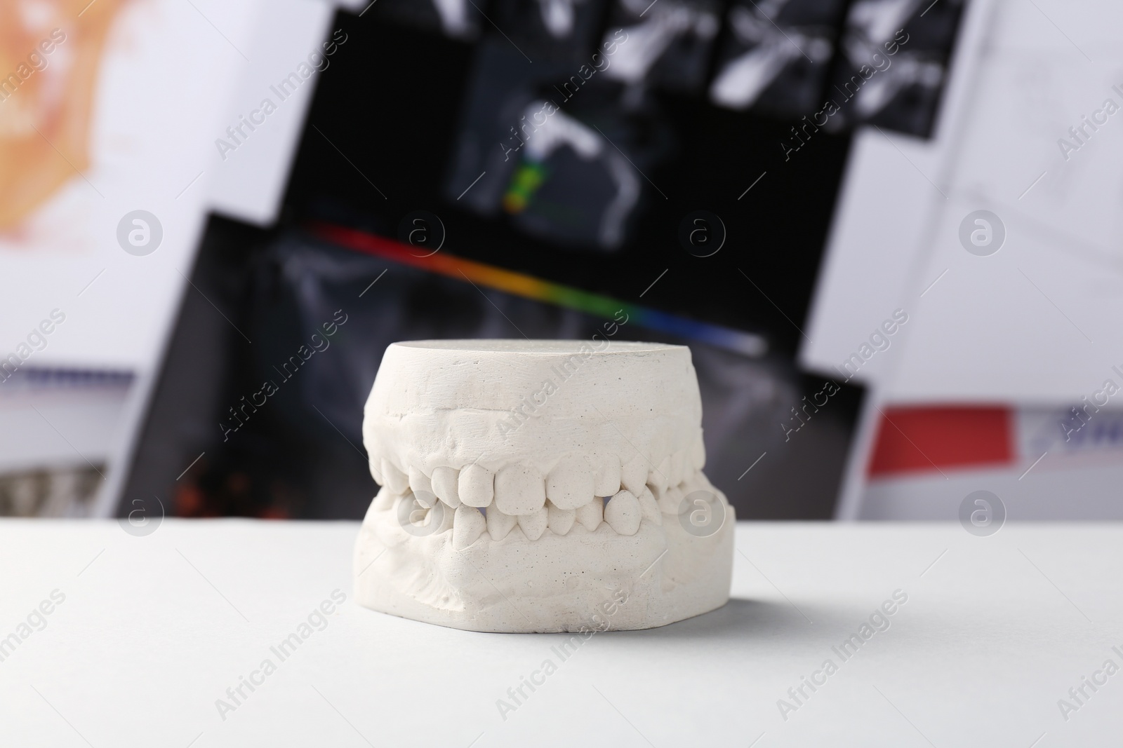 Photo of Dental model with gums on white table against panoramic x-ray. Cast of teeth