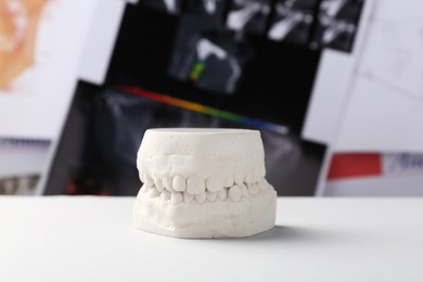 Dental model with gums on white table against panoramic x-ray. Cast of teeth