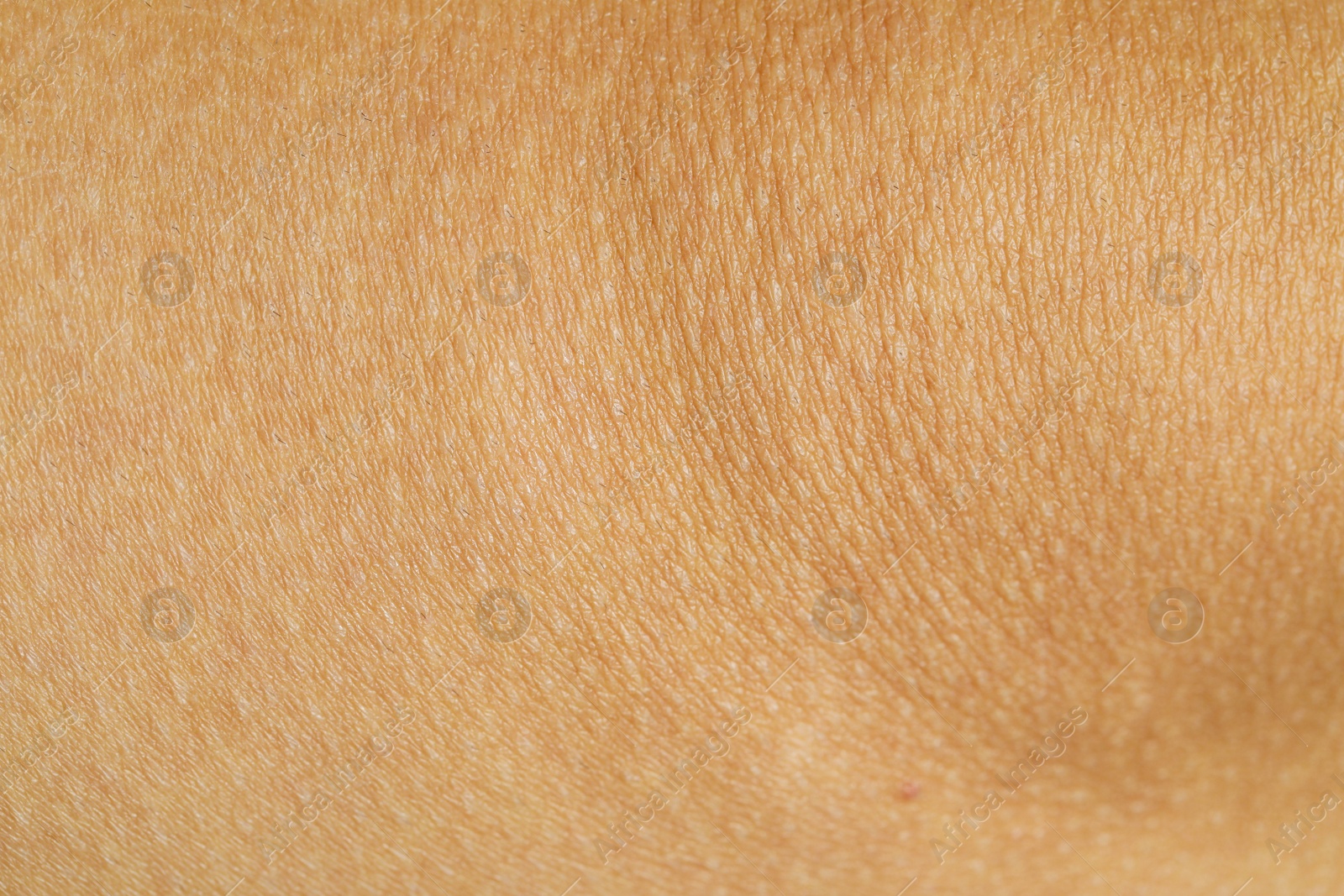 Photo of Texture of human skin as background, closeup view