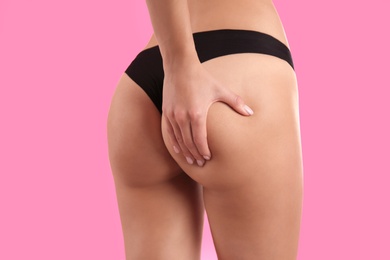 Photo of Closeup view of slim woman in underwear on color background. Cellulite problem concept