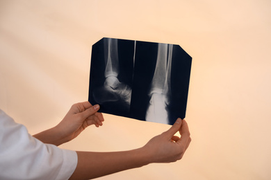 Photo of Orthopedist examining X-ray picture on viewing screen, closeup