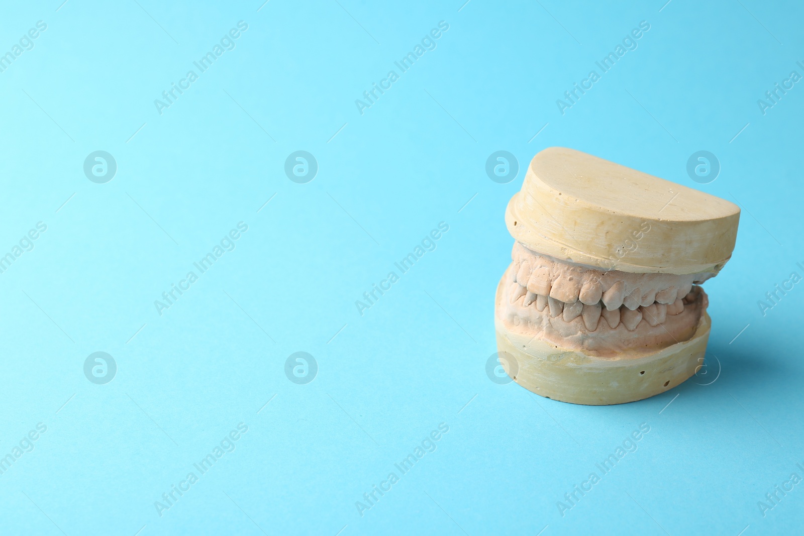 Photo of Dental model with gums on light blue background, space for text. Cast of teeth