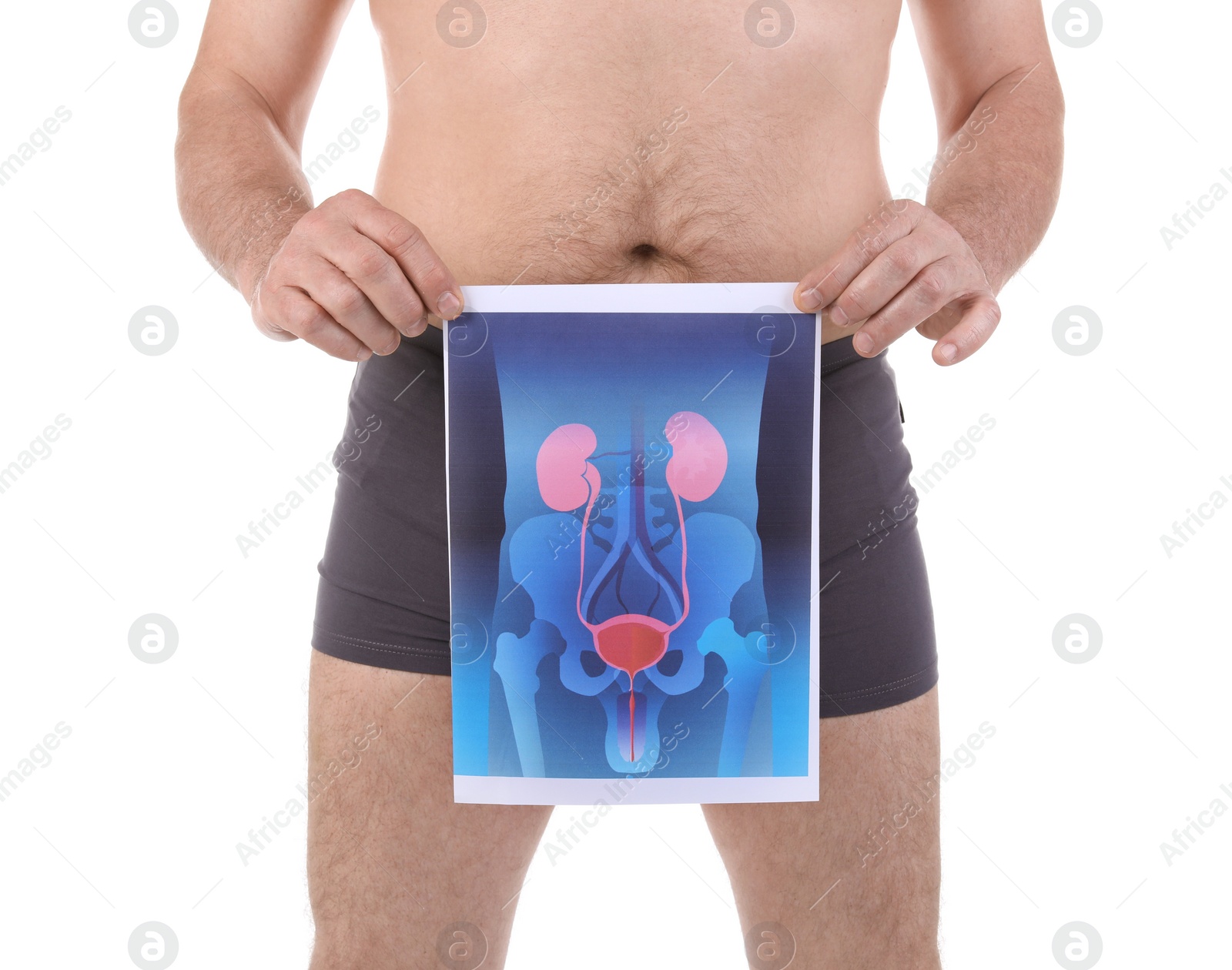 Photo of Mature man holding picture of urinary system on white background