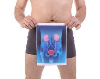 Photo of Mature man holding picture of urinary system on white background