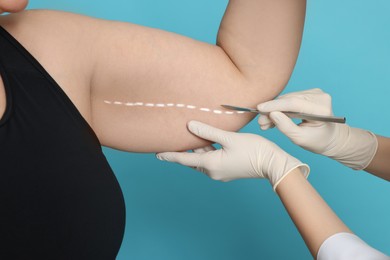 Photo of Doctor with scalpel near obese woman on light blue background, closeup. Weight loss surgery
