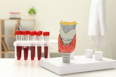 Photo of Endocrinology. Model of thyroid gland and samples of blood in test tubes on white table at clinic