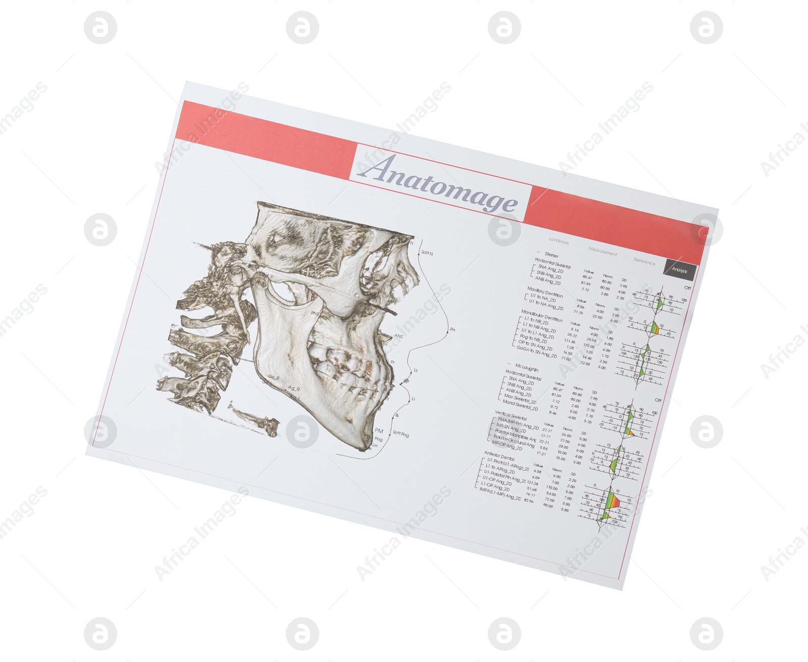 Photo of Visualization of human maxillofacial section for dental analysis printed on paper isolated on white