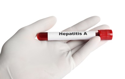 Scientist holding tube with blood sample and label Hepatitis A on white background, closeup