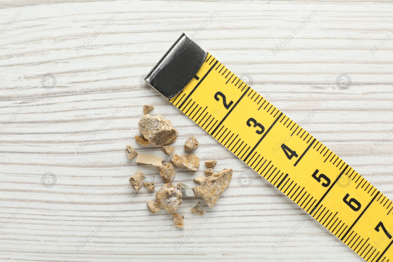 Photo of Kidney stones and measuring tape on white wooden table, flat lay