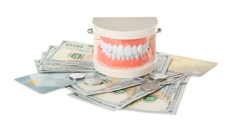 Photo of Educational dental typodont model, money and credit cards on white background. Expensive treatment
