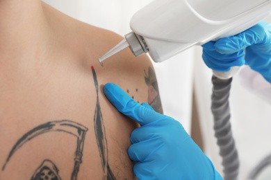 Photo of Man undergoing laser tattoo removal procedure in salon, closeup