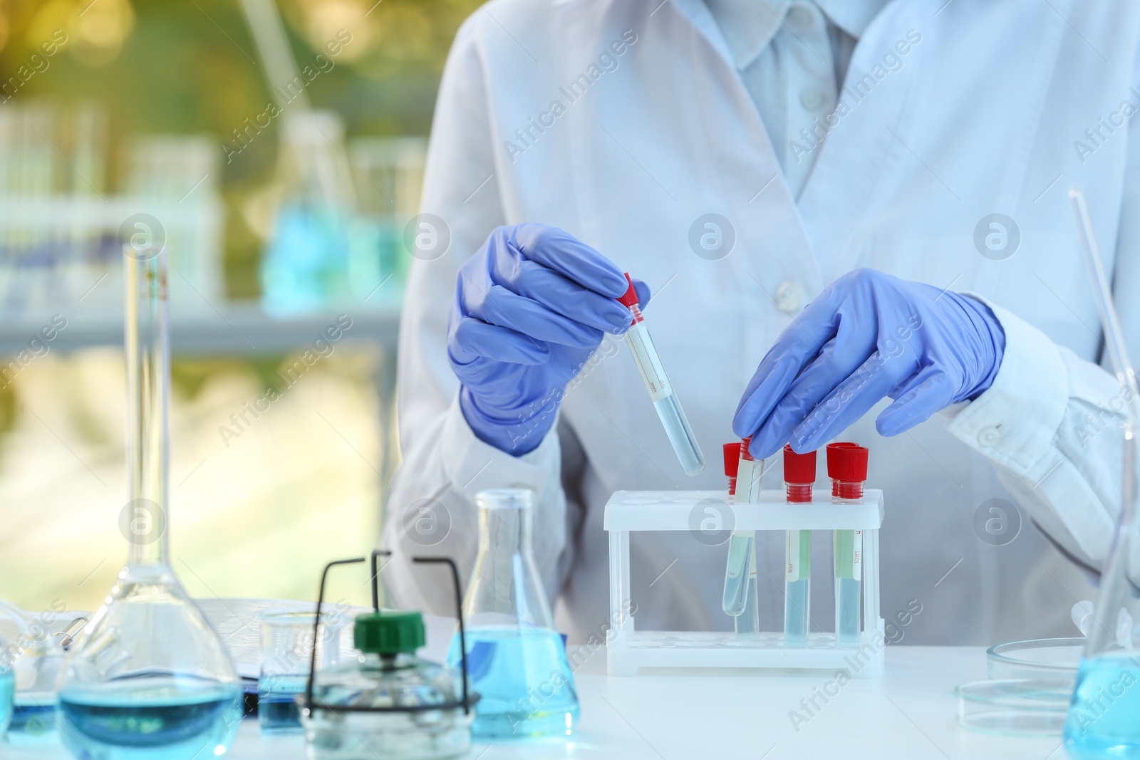 Photo of Scientist working with sample in laboratory, closeup. Medical research