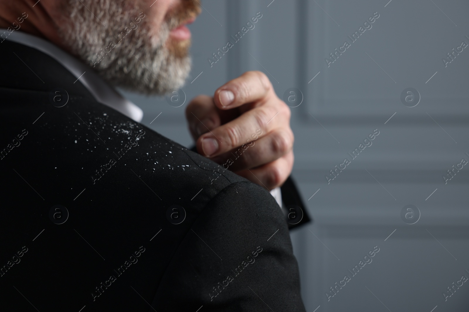 Photo of Bearded man brushing dandruff off his jacket on grey background, closeup. Space for text