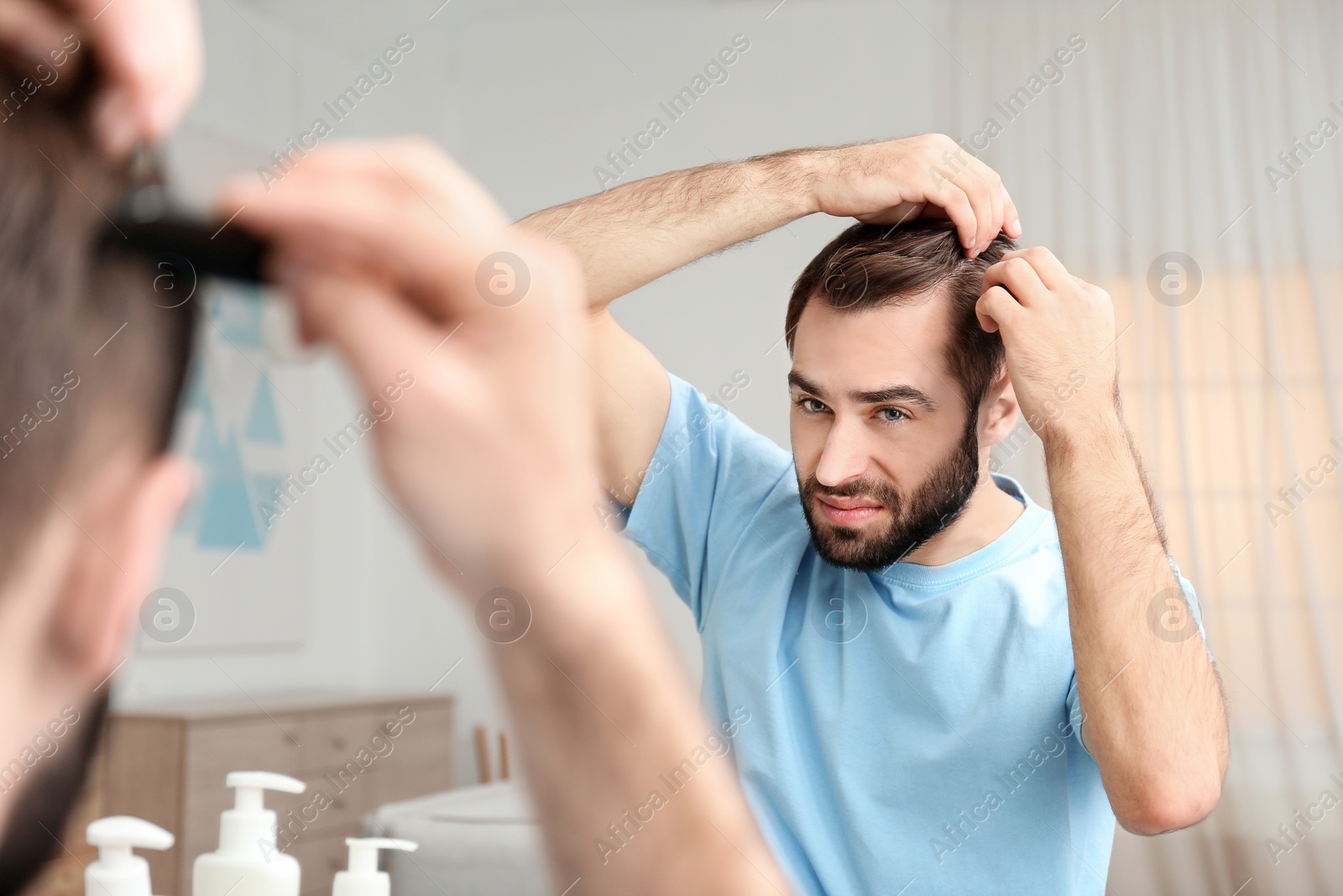 Photo of Young man with hair loss problem in front of mirror indoors