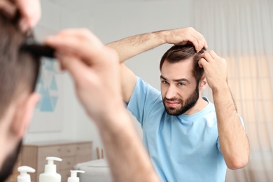 Young man with hair loss problem in front of mirror indoors