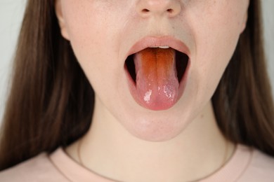 Gastrointestinal diseases. Woman showing her yellow tongue, closeup