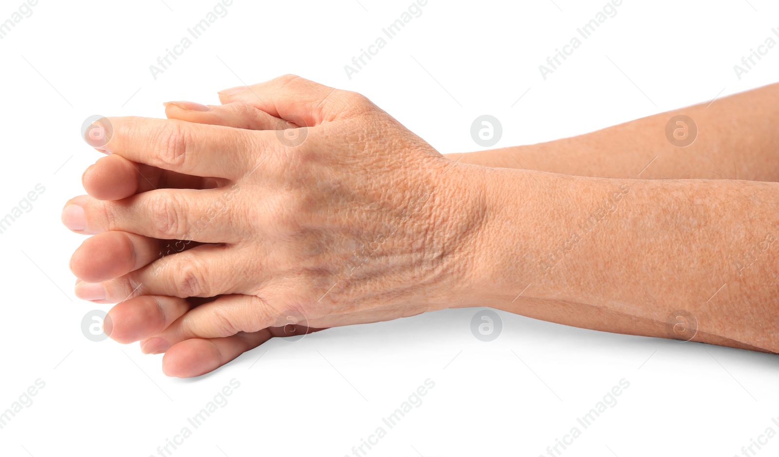 Photo of Closeup view of woman's hands with aging skin