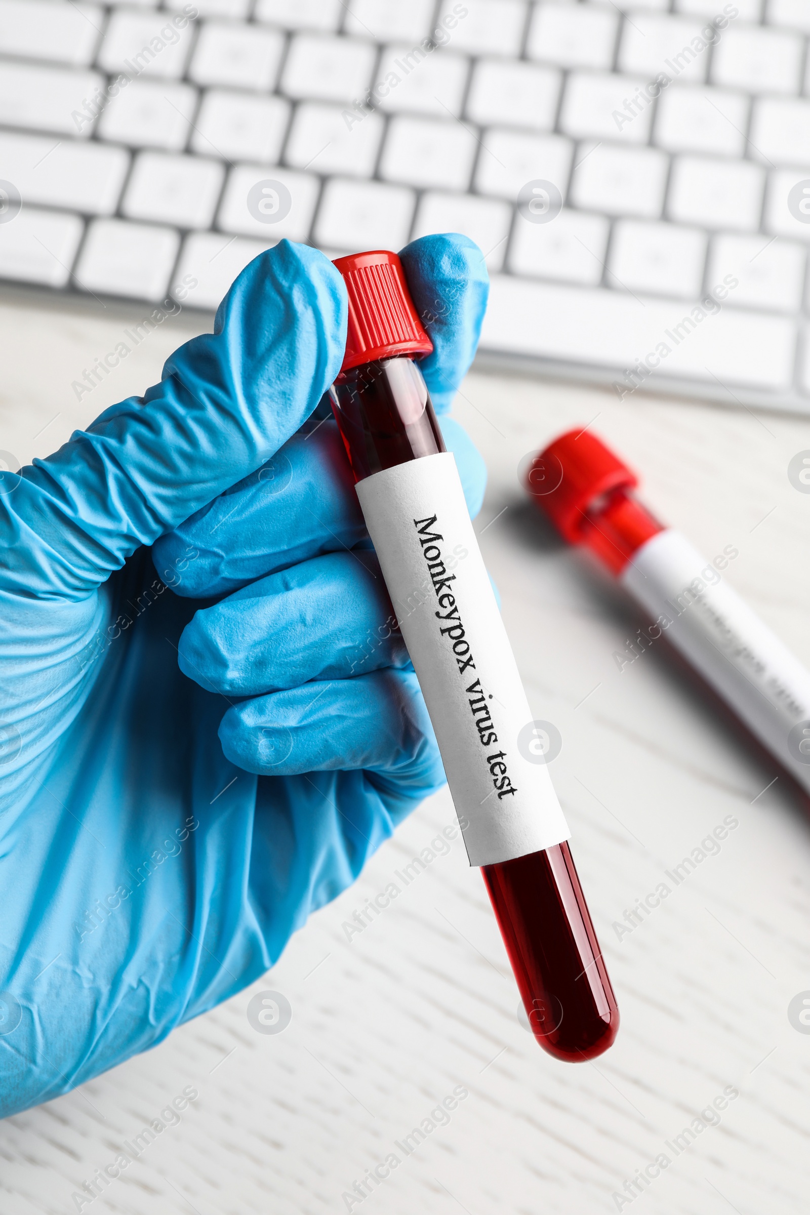 Photo of Monkeypox virus test. Laboratory worker holding sample tube with blood over table, closeup