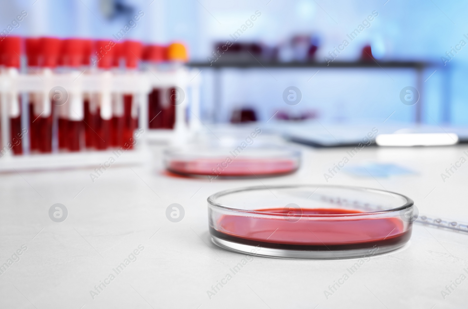 Photo of Petri dish with blood sample for analysis on table in laboratory