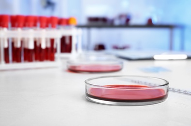 Photo of Petri dish with blood sample for analysis on table in laboratory