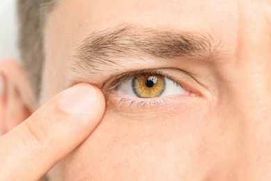 Photo of Young man, closeup of eye. Visiting ophthalmologist